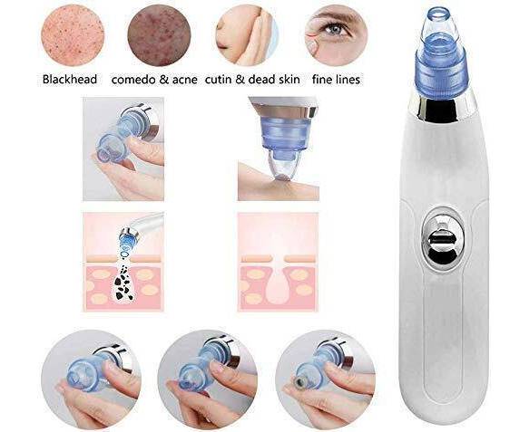 Blackhead Removal Machine – Derma Suction 3 In 1 Black Head Remover Machine-Acne Pimple Pore Cleaner Vacuum Suction Tool